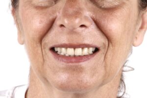 Un buen mantenimiento es clave para la salud bucodental de nuestros pacientes