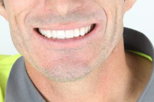 Aplicamos nuestra experiencia para una sonrisa perfecta con técnicas avanzadas